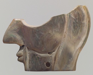 Inlay